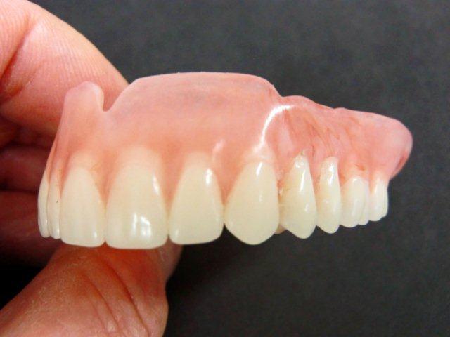 best dental implant in kolkata