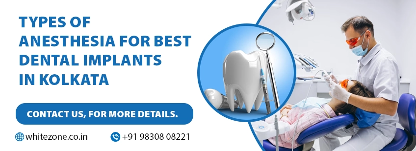 Best Dental Implants in Kolkata